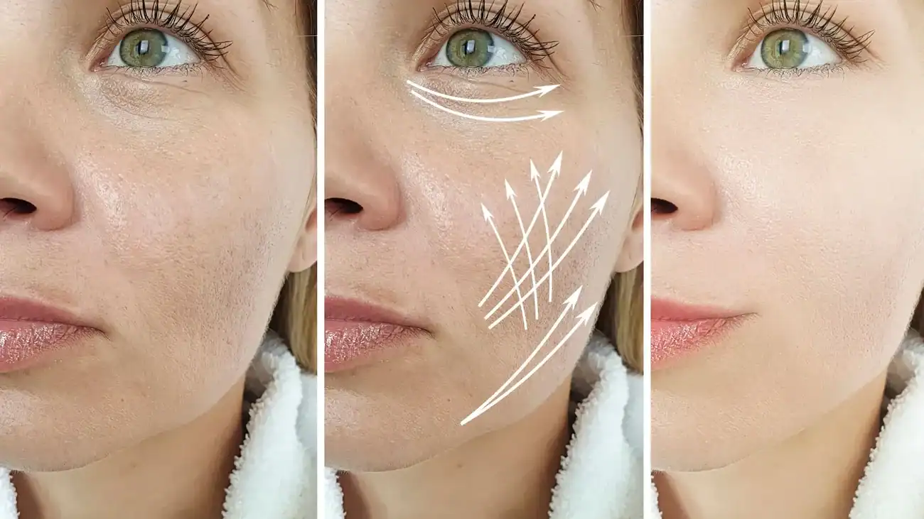 Can One Treatment Really Tackle More Than One Skin Concern Rayleigh?