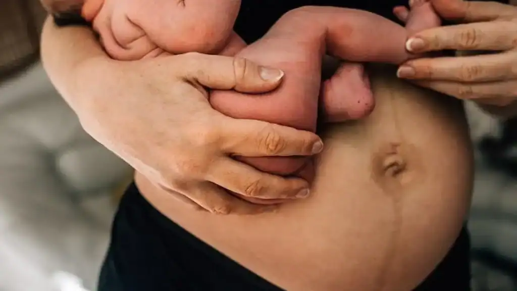 Why Is My Stomach Still Big After Pregnancy Rayleigh?
